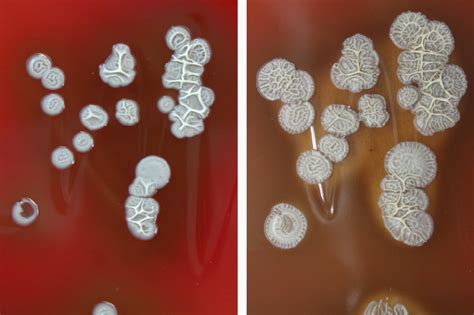 blood agar colony morphology